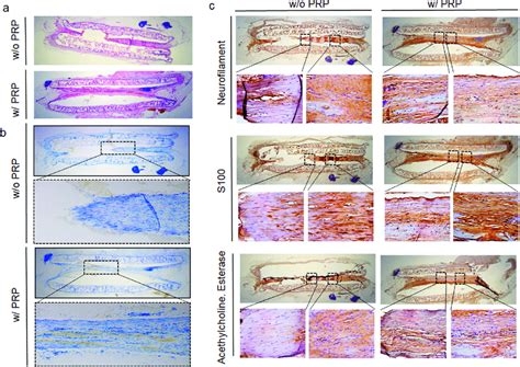 Histologic Evaluation And Immunohistochemistry Analysis Of Regenerated