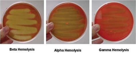 Micro Lecture 21 Staphylococcus Spp And Streptococcus Spp