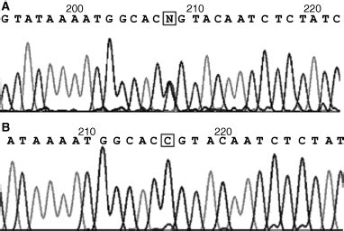 Female Hemophilia A Heterozygous For A De Novo Frameshift And A Novel