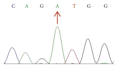 Sanger Sequencing Chromatogram Showing A Portion Of The Sequenced