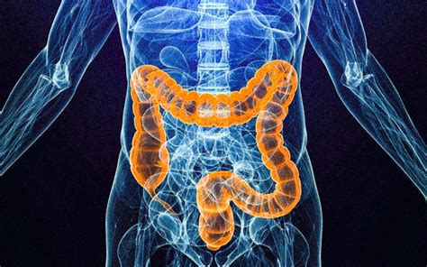 What Is Colon Cancer Symptoms Causes Diagnosis And Treatment