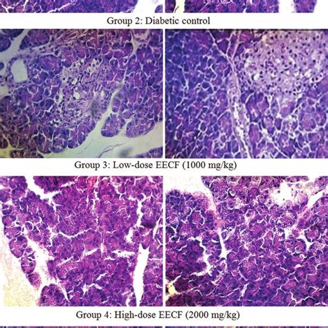 Histopathology Of The Pancreas In Rats Photomicrograph Of Hematoxylin