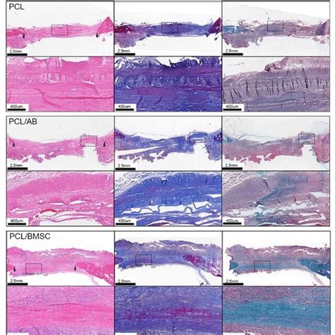 Histological Analysis Of Bone Regeneration In Cranial Defects At 3