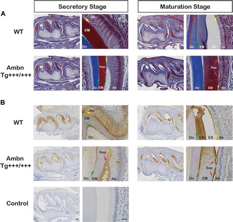 Frontiers Overexpression Of Ameloblastin In Secretory Ameloblasts