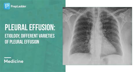 Pleural Effusion Etiology And Different Varieties