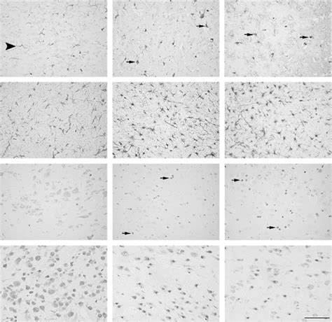 Representative Photomicrographs Showing Iba Gfap Cleaved Caspase