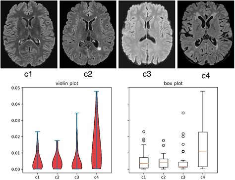 Frontiers Multiple Sclerosis Lesion Segmentation Revisiting