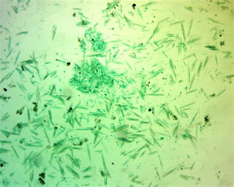 Bacillariophyta (Diatoms): Definition, Characteristics, Cell Structure ...