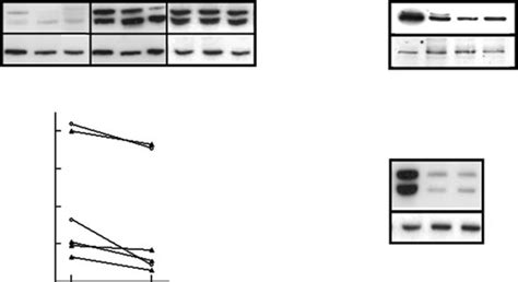 Curcumin Decreases P38 Mitogen Activated Protein Kinase Mapk