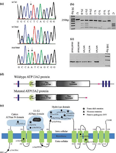 Pdf Novel Mutation In Atp A Widens The Spectrum Of Kufor Rakeb