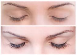 Loss of Eyelashes: Causes, Symptoms, Treatment & Prevention