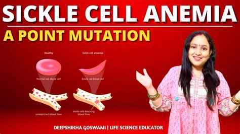 SICKLE CELL ANEMIA GENETICS AMINO ACID MUTATION YouTube