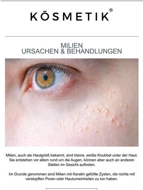 K Smetik Schnelle Hilfe Gegen Milien Milled