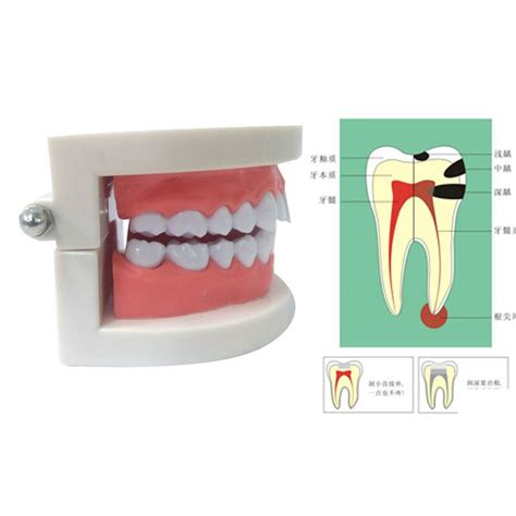 ABS PVC Model dentystyczny narzędzia robić jamy ustnej materiały