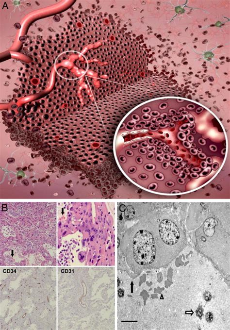 Vascular Mimicry A Vascular Mimicry Is The Ability Of Tumor Cells To