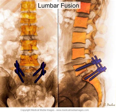 Color X Ray Medical Images Of A Front Anterior And Side Lateral