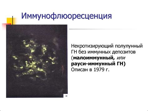 Системные васкулиты - презентация онлайн
