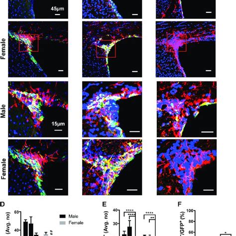 Expression Of CaMKII TTA Is Restricted To Mature Excitatory Neurons