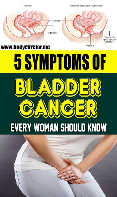 5 Symptoms Of Bladder Cancer Every Woman Should Know