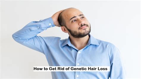 How To Get Rid Of Genetic Hair Loss Magazetty