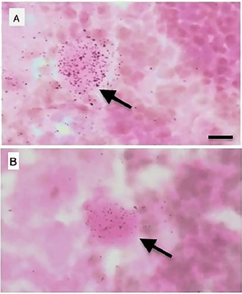 Microphotographs Of Labeled Purkinje Cells In The Cerebellum Purkinje