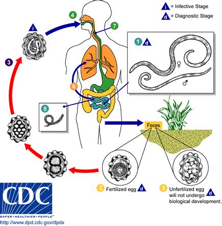 Ascariasis pathophysiology - wikidoc