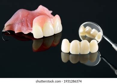 Partial Denture Upper Photos, Images & Pictures | Shutterstock