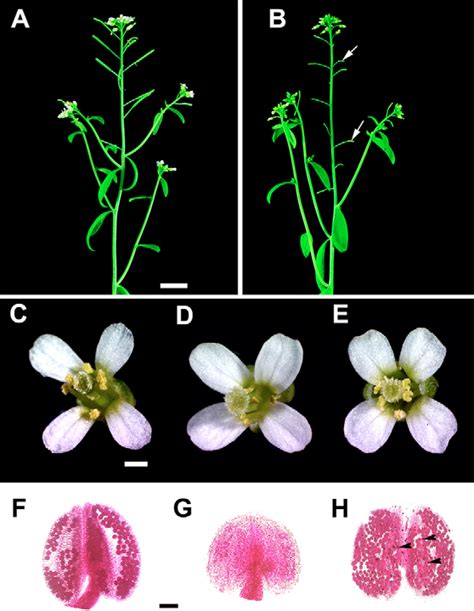 Figure 1 From Regulation Of Arabidopsis Tapetum Development And