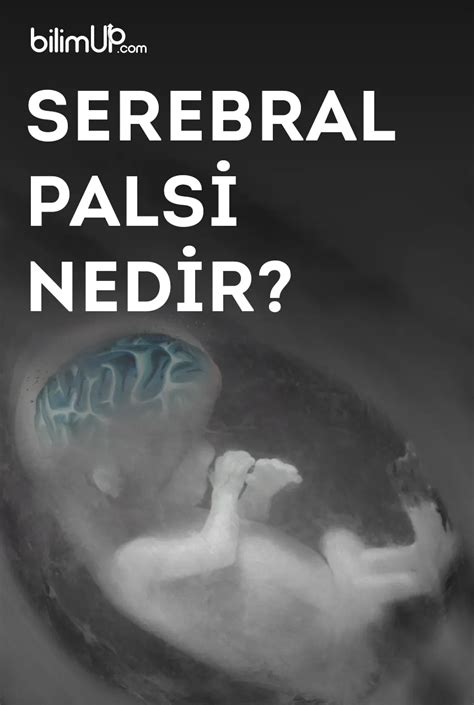 Serebral Palsi Nedir BilimUP