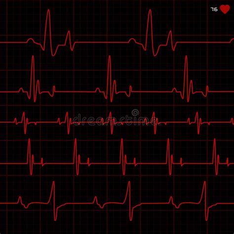 Vector Cardiogram Stock Vector Illustration Of Monitor 14438640