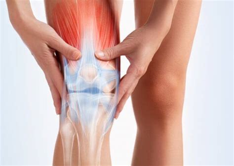 Surgical Arthrofibrosis Treatment Orthopedic Knee Surgeon Manhattan