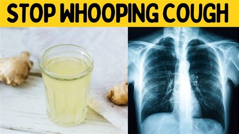 How To Stop Whooping Cough Naturally Immediately At Night Natural Home Remedy Youtube