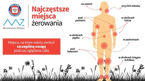 W te miejsca na ludzkim ciele kleszcze wbijają się najczęściej