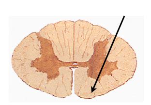 Spinal Cord Anatomy Lab Practical 2 Flashcards Quizlet