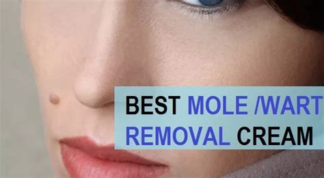 Top 9 Best Mole Removal Creams in India with Prices