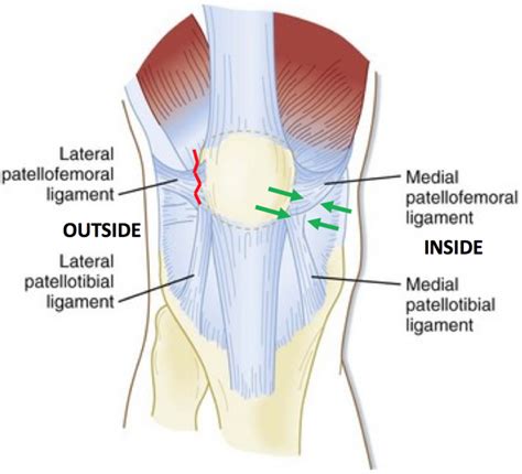 Patella Stabilisation Treatment | David Slattery