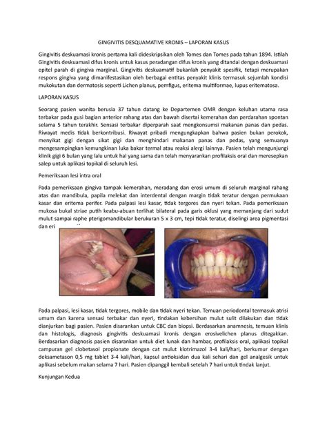 Resume Jurnal 1 Surgery Class Gingivitis Desquamative Kronis Laporan Kasus Gingivitis