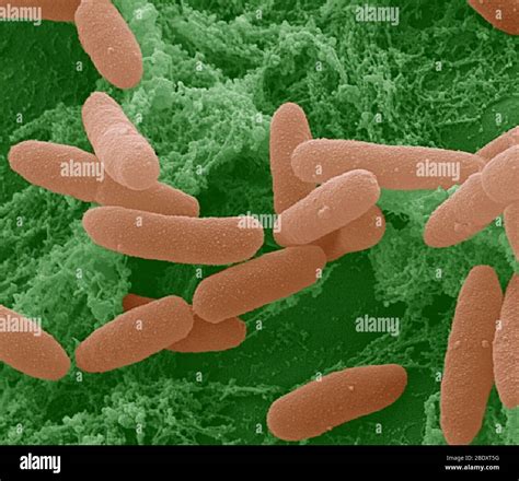 Bacteria Sem E Coli Hi Res Stock Photography And Images Alamy