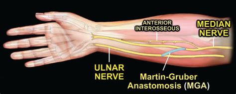 Comprehensive Summary Of Anastomoses Between The Median And Ulnar