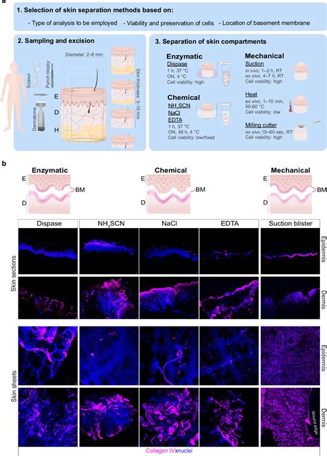 Figure From Epidermal Dermal Separation Techniques And Analysis Of