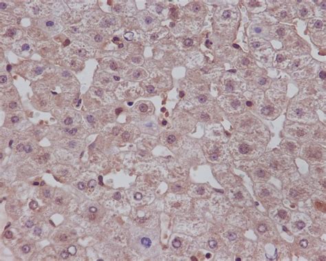 Anti Notch1 Monoclonal Antibody IHC IF Validated Bosterbio