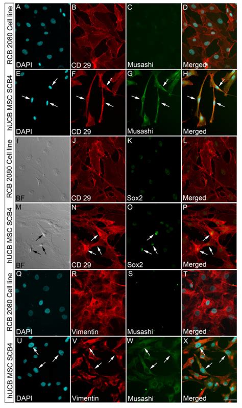 Human Ucb Msc Scb4 Express Neural Progenitor Marker Without Losing Download Scientific Diagram