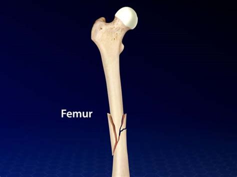 Dr. Ashutosh Agarwal | Arthroscopic & Joint Replacement Surgeon