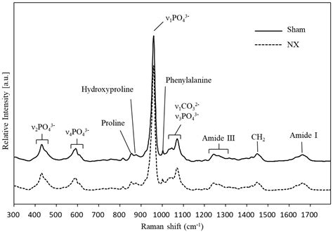 Molecules Free Full Text Raman Spectroscopic Analysis To Detect