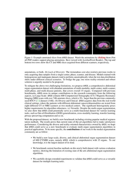 AMOS A Large Scale Abdominal Multi Organ Benchmark For Versatile