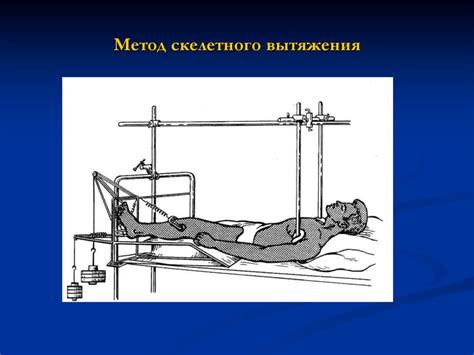 Травматизм. Социально-экономическое значение. Принципы оказания ...
