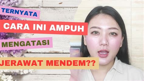 Rahasia Kulit Sehat Cara Mengatasi Jerawat Mendem Dengan Tips Ampuh