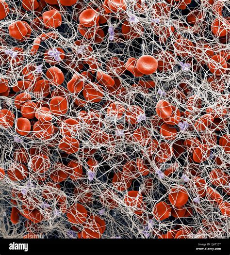 Red blood cells and platelets in blood clot, SEM Stock Photo - Alamy