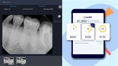 Overjet and Sunbit partner for payment and AI treatment options