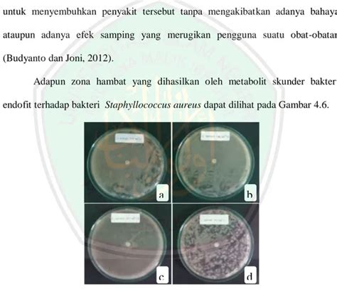 Uji Aktivitas Metabolit Bakteri Endofit Dari Rumput Kebar Biophytum Sp Terhadap Bakteri